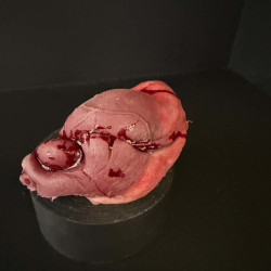 Human Heart