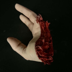Lacerated Hand